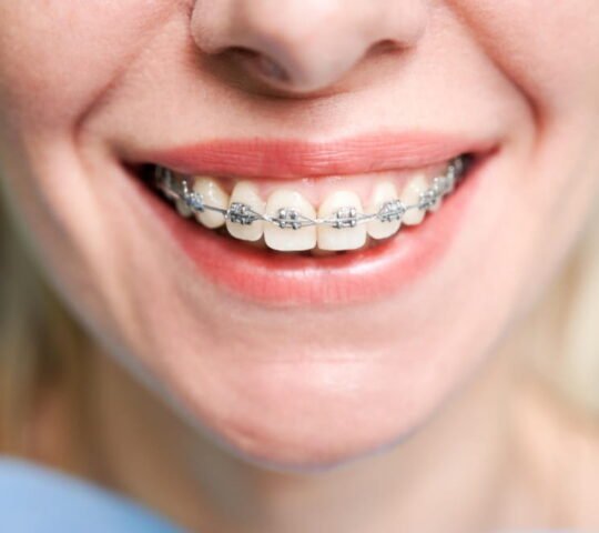 Smylo Dental & Implant Center